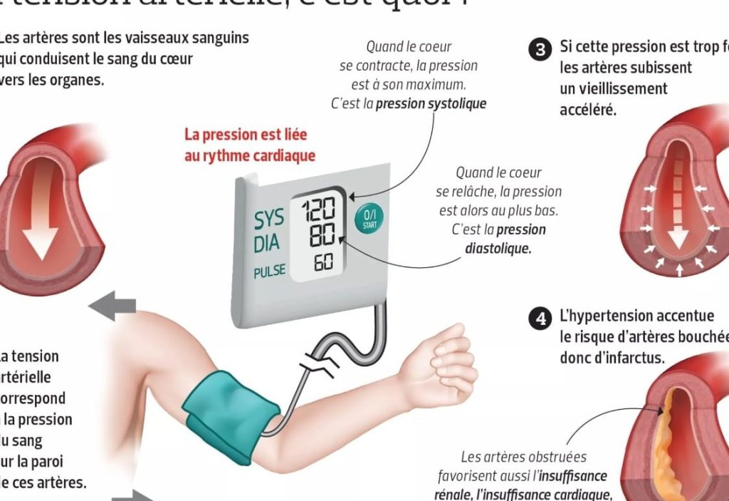 artérielle